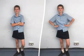Toby has worn a skirt to school in protest of the school’s dress code which stops male students wearing shorts.  (SWNS)