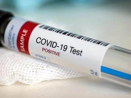 Tests can be arranged through the Government's coronavirus testing webpage, which also includes details of eligibility for testing