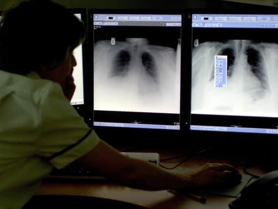 Public Health England data shows  37.2 per cent of patients diagnosed with lung cancer in Lancashire lived another year