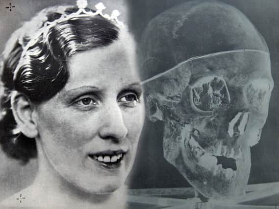 Photo of murder victim Isabella Ruxton next to photo of one of the skulls of Buck Ruxton’s victims