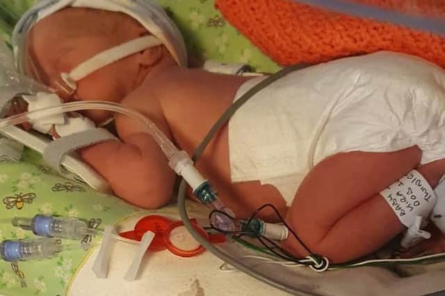 Dakota being cared for in hospital after being born eight weeks early.