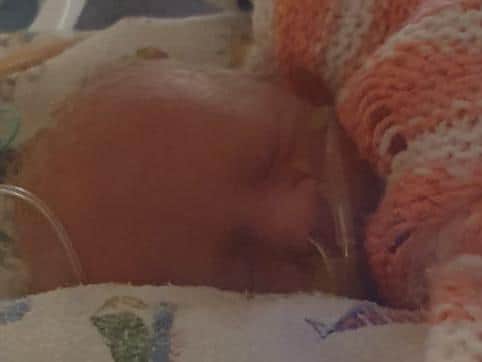Willow being cared for in hospital after being born eight weeks early.