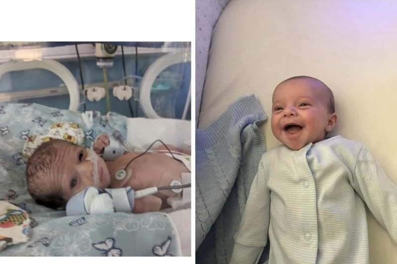 Harry Skelly, born May 7 aged 34 weeks, weighing 3.5lb - now a happy 11lb.