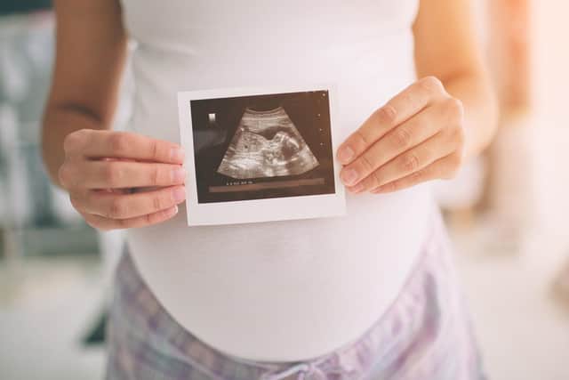 The home birth kits will help mums under the care of Morecambe Bay midwives.