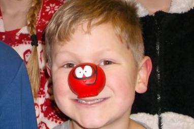 Pupils from Scorton and Calder Vale schools enjoyed Red Nose Day 2015, including this cheeky chappie