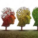 Alzheimer's disease is the leading cause of dementia and disability in old age.