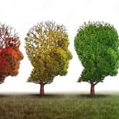 Alzheimer's disease is the leading cause of dementia and disability in old age.