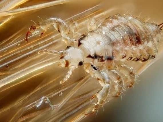 Protect your family from summer-loving lice