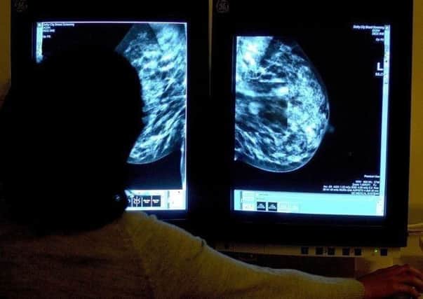 Breast cancer screening. Pic by PA.