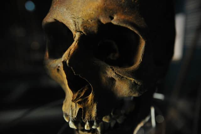 A picture taken on May 7, 2013 shows the skull of a crew member recovered from the wreck of the Tudor warship Mary Rose on display during a press preview of the new Mary Rose Museum in Portsmouth, Hampshire, southern England. The relics from the Mary Rose, the flagship of England's navy when it sank in 1545 as a heartbroken king Henry VIII watched from the shore, have finally been reunited with the famous wreck in a new museum offering a view of life in Tudor times. Skeletons, longbows, tankards, gold coins and even nit combs are going on display alongside the remains of the pride of Henry's fleet. Thousands of the 19,000 artefacts excavated from beneath the seabed can be seen in the new 27 million GBP (41 million USD, 32 million euro) Mary Rose Museum in Portsmouth on England's south coast, which opens on May 30. AFP PHOTO / CARL COURT        (Photo credit should read CARL COURT/AFP/Getty Images)