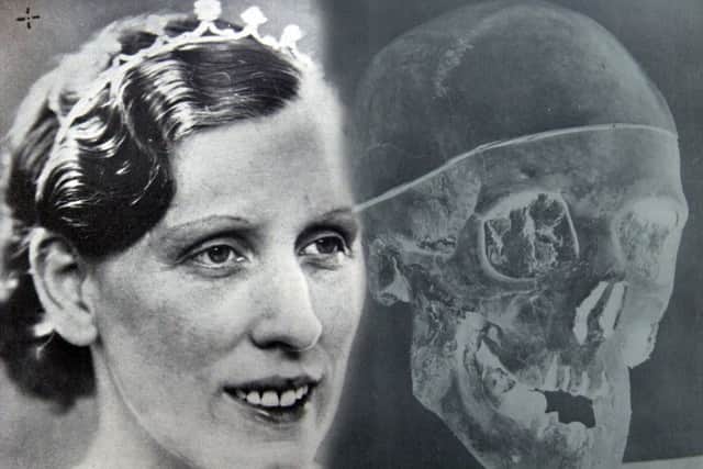 Buck Ruxton's wife Isabella Ruxton who he murdered and dismembered. She was eventually identified using forensic techniques which involved superimposing a photograph onto her skull.