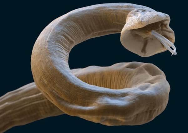 Lung worm