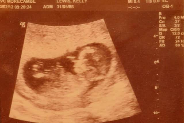Baby Ellissia's scan.