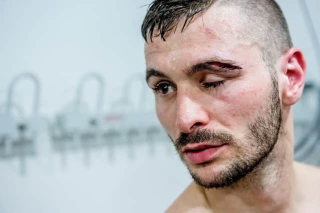 Dennis Ceylan's cut that ended the fight.