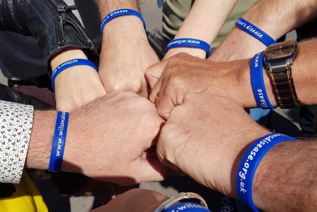 Wristbands to raise awareness and raise funds for the Wilson's Disease support group were sold at a recent family fun day.