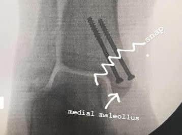Andy's x-ray.